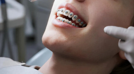 Straighten Teeth Faster: Phototherapy's Orthodontic Breakthrough